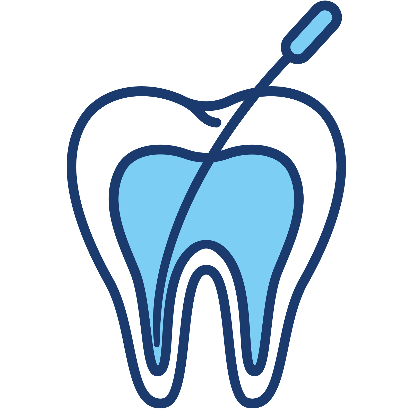 Root Canal Treatment