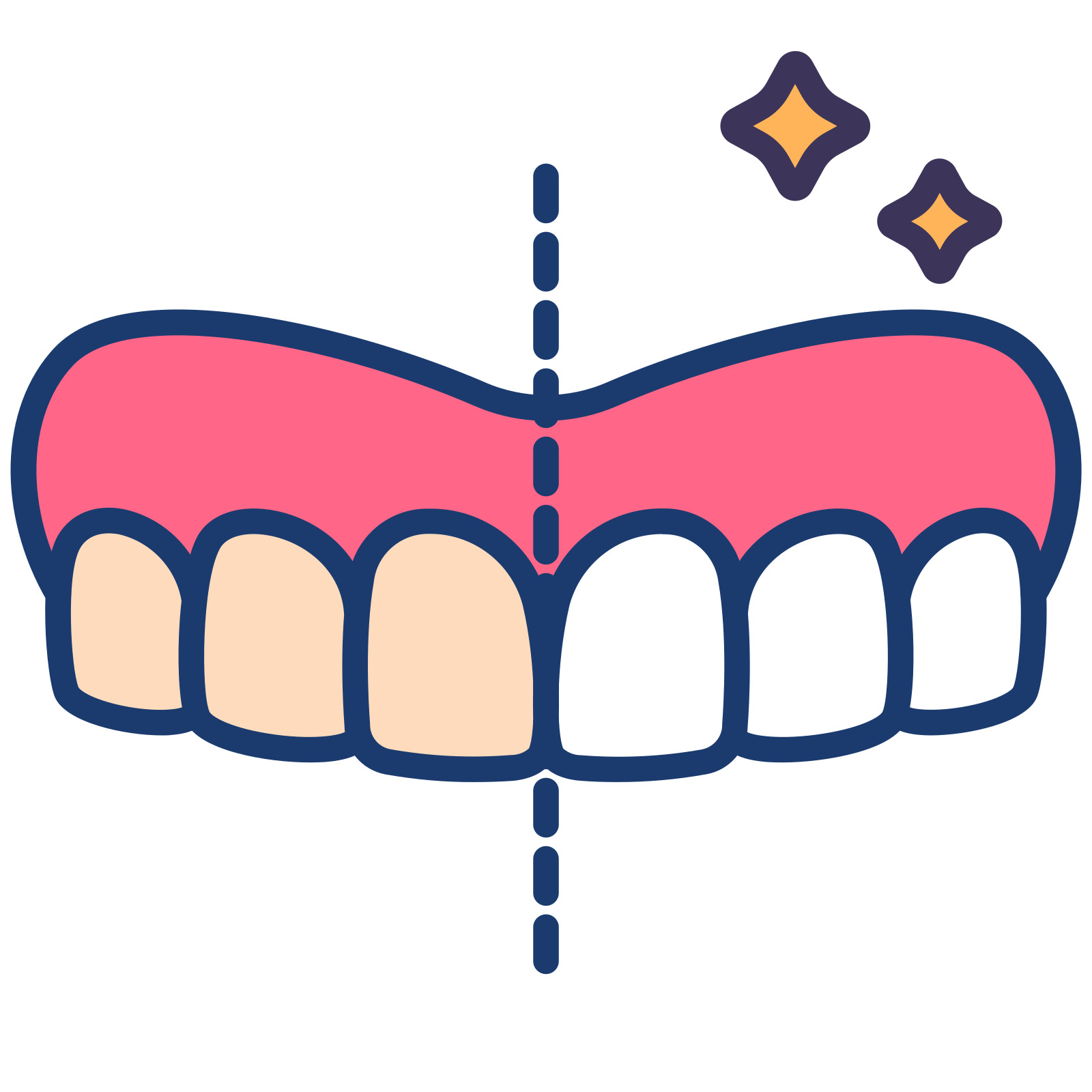 Teeth Whitening