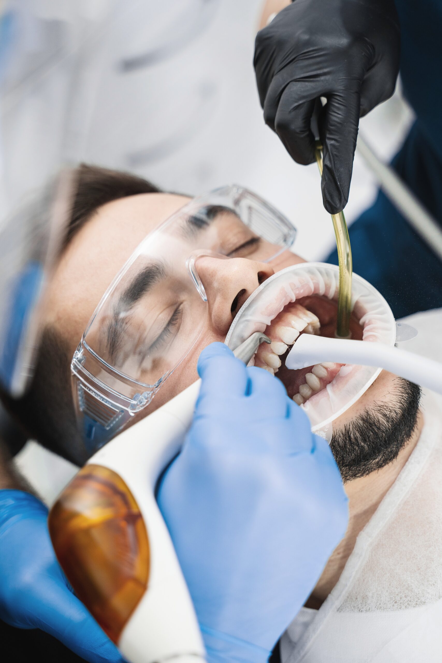 Dental professional polishing teeth during a professional cleaning appointment.