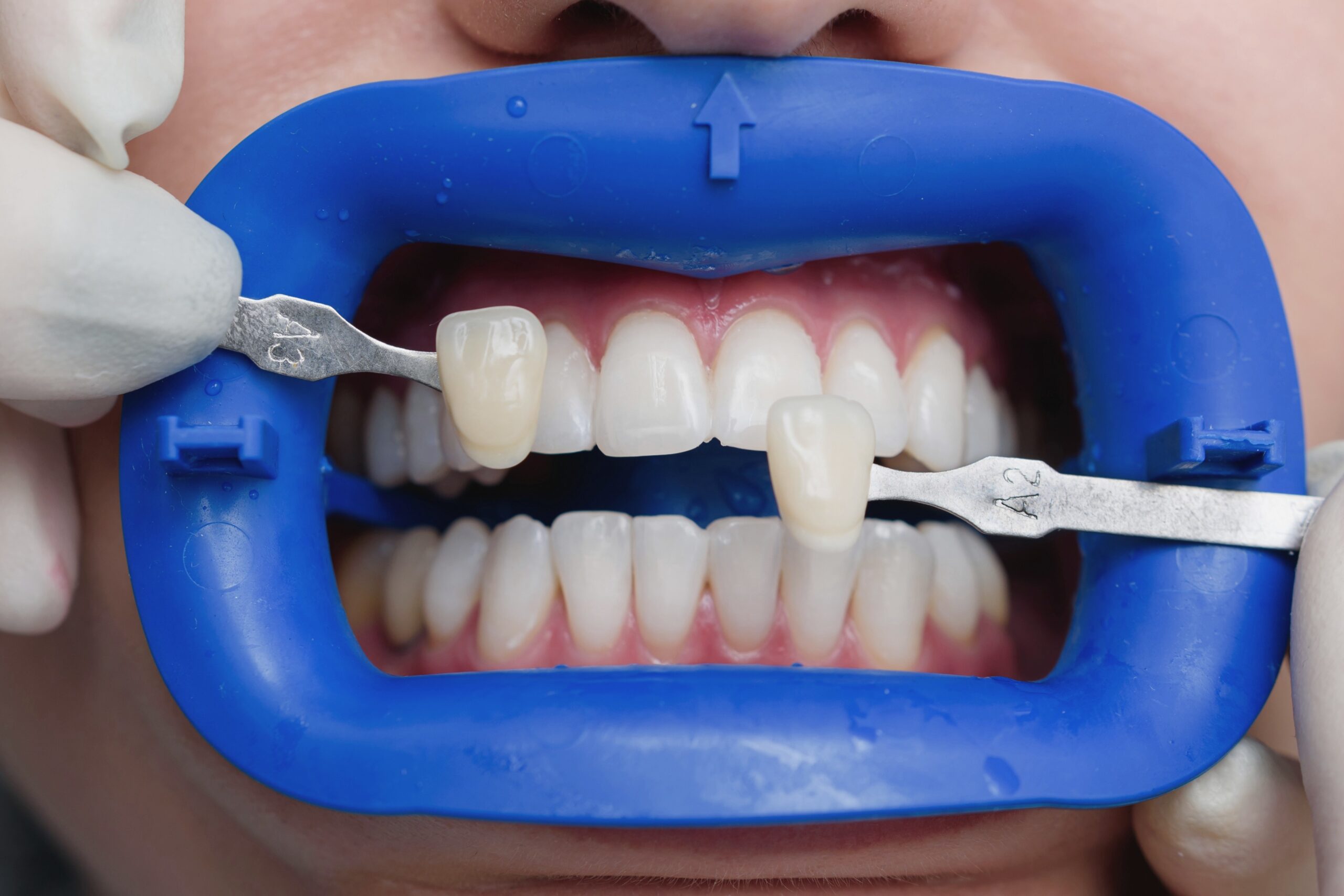 restorative-dentistry restorative-dentistry