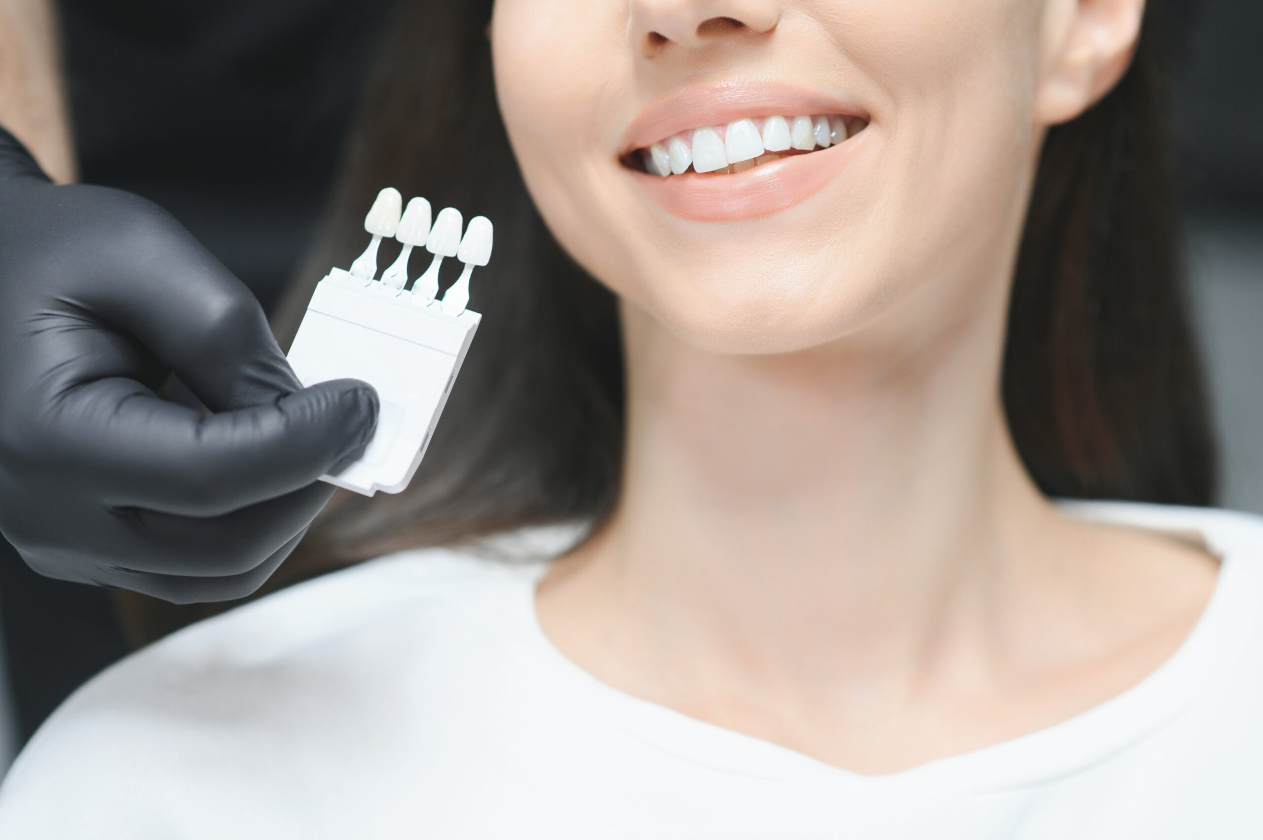 teeth-whitening