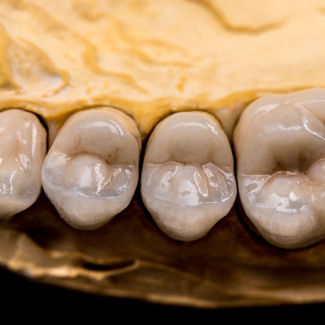 Dental-Se