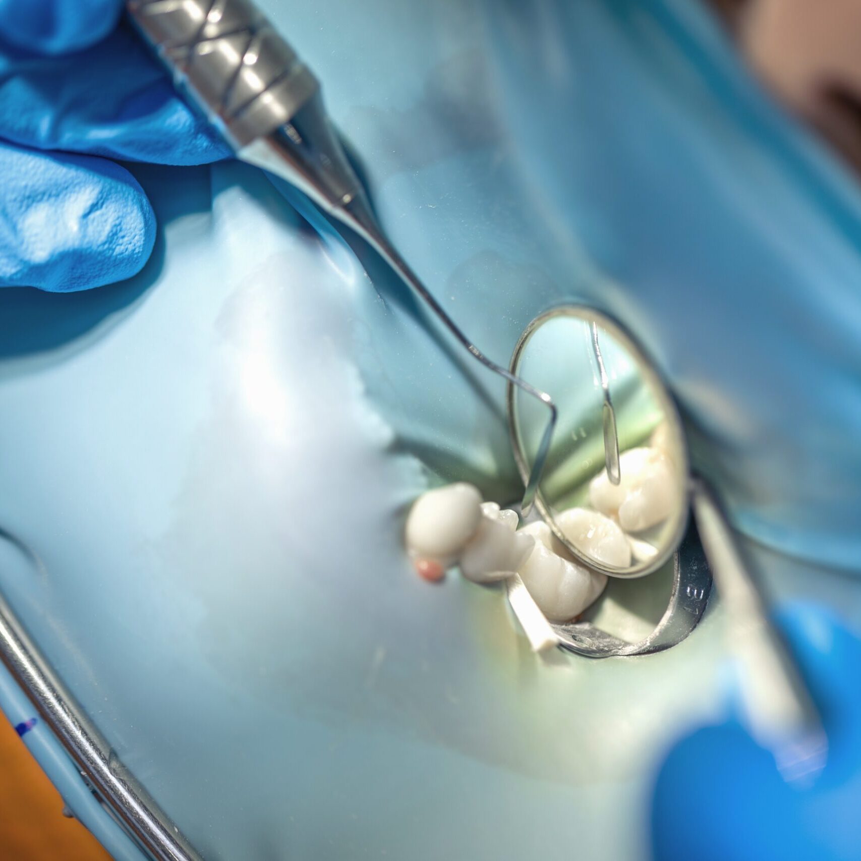 fillings